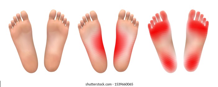 vector set of legs with red patches of pain on a white background