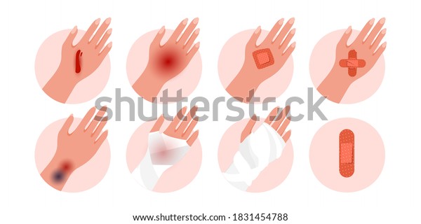 Vector Set Physical Injury Human Hand Stock Vector (Royalty Free ...