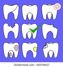 Vector Set of Rotten Teeth and Healthy Isolated on Blue Background. Dental Treatment. SevereToothache. Filled Tooth. Symbol of Carre and Health.