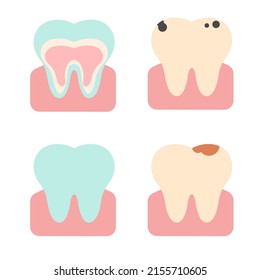 Vector set of teeth in different states. Flat illustration