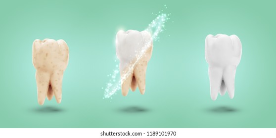 vector set of three molars. tooth cleaning, care and protection from tooth decay.