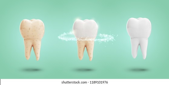 conjunto vectorial de tres molares. limpieza dental, cuidado y protección contra la caries dental.