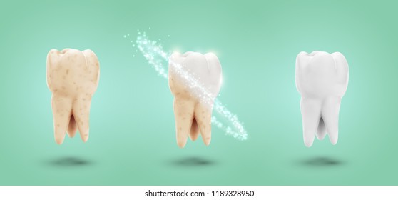 vector set of three molars. tooth cleaning, care and protection from tooth decay.