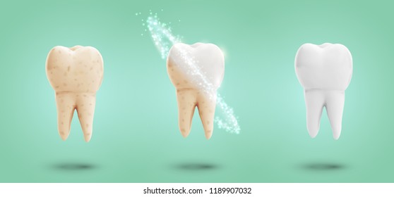 vector set of three molars. tooth cleaning, care and protection from tooth decay.