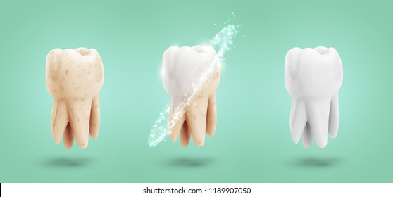 vector set of three molars. tooth cleaning, care and protection from tooth decay.