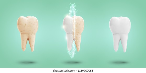 vector set of three molars. tooth cleaning, care and protection from tooth decay.