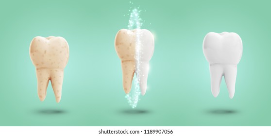 vector set of three molars. tooth cleaning, care and protection from tooth decay.