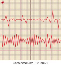 Vector Set of various cardiogram design elements. 