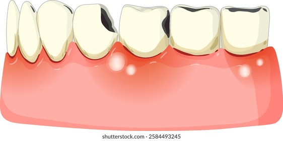 Vector showing teeth and gum health issues