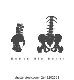 A vector silhouette of human hip bones, An illustration of Human hip structure, A vector silhouette for creating orthopaedic hospital logo