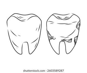 Vector sketch Black and white line illustration of a healthy tooth and a decayed tooth. Dental care concept showing tooth decay and oral hygiene comparison.