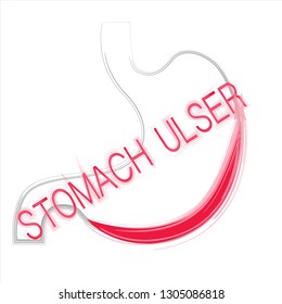 vector stomach shape, haemorrhage and stomach ulcer writing 
