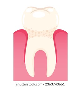 Vector strong tooth in gum on white background.