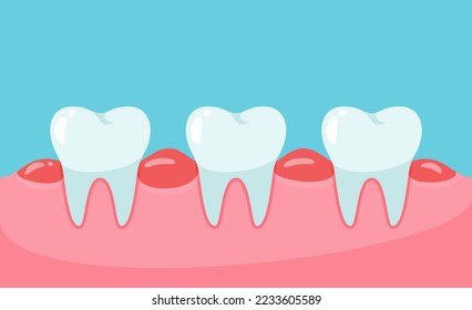 vector swollen teeth. unhealthy gums