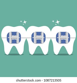 Vector teeth braces flat illustration