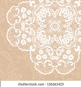 Vector template. Invitation card.