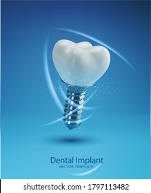 Vector template with realistic 3d prosthesis. Dental implant isolated on a blue background. Element for design.