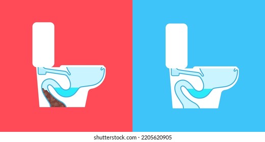 Vector toilet detergent illustration. Garbage stuck in a plumbing pipe. Cleaning service advertising poster. Home bathroom problems. Sanitary home clean method. Ceramic dirty blocked problem. WC wash