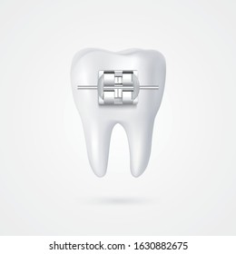 vector tooth braces illustration 3d style white background