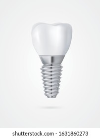 vector tooth implant 3d illustration white background