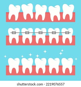 llave dental ortodoncia. iconos de estilo plano. 