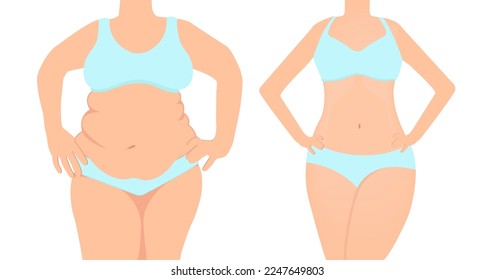 Vector de una mujer antes y después de la dieta pérdida de peso.