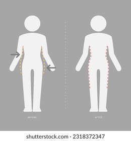 Vector woman body pictogram before and after losing weight.
Yellow outline shows overweight from fat to slim figure with arrows. Editable weight loss icon template.
Waist, belly, hip and buttocks lost