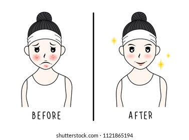 Vector Woman Face Acne Before After Stock Vector (royalty Free 