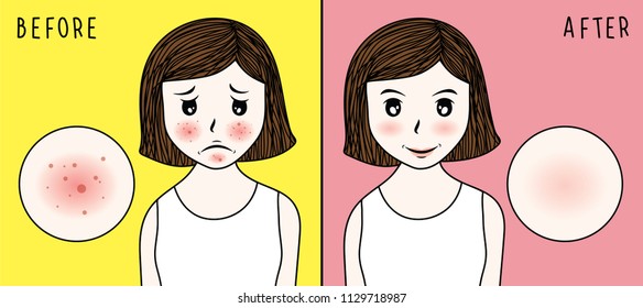 vector woman face. acne before and after. skin care illustration.