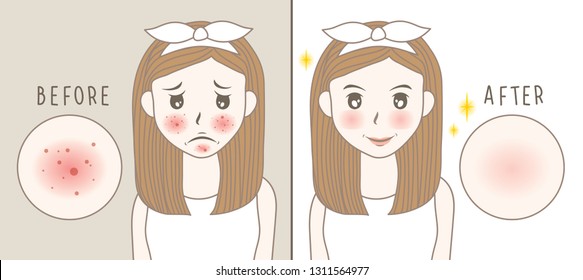 vector woman face. acne before and after. skin care illustration.