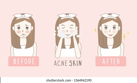 vector woman face. acne before and after. skin care illustration.