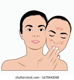 
vector of a woman's face affected by acne and back to normal