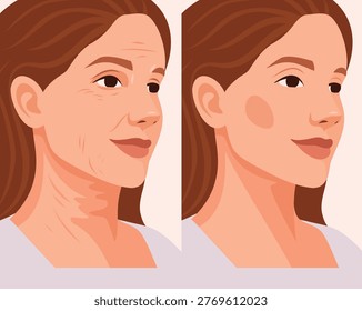 Vector woman's face before and after skincare and rejuvenation procedures. Signs aging include wrinkles, sagging skin, and smooth, rejuvenated skin. For cosmetic, dermatological, anti-aging treatments