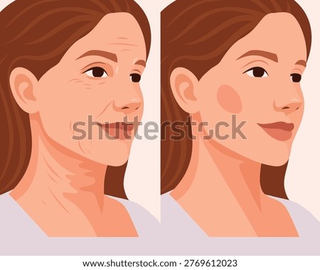 Vector woman's face before and after skincare and rejuvenation procedures. Signs aging include wrinkles, sagging skin, and smooth, rejuvenated skin. For cosmetic, dermatological, anti-aging treatments