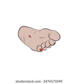 Vector woman's foot with open wound.	