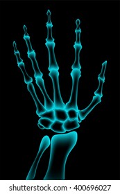 15,100 Hand_xray Images, Stock Photos & Vectors | Shutterstock