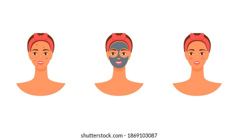 vector of young woman wearing face mask set. acne before and after. skin care flat illustration