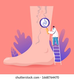 Vein Thrombosis and Varicose Treatment Concept. Tiny Doctor Character Stand on Ladder with Magnifying Glass Looking on Huge Foot with Diseased Veins. Health Care, Podiatry. Cartoon Vector Illustration