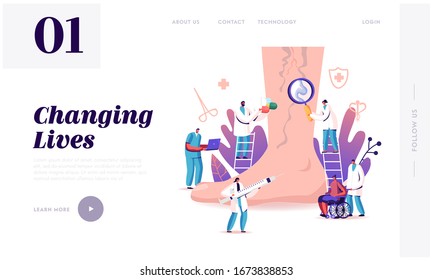 Vein Thrombosis, Varicose Treatment Landing Page Template. Tiny Doctor Characters with Medical Instruments and Drugs at Huge Foot with Diseased Veins, Health Care. Cartoon People Vector Illustration