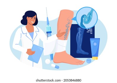 Vein Thrombosis and Varicose Treatment. Surgeon treat vascular diseases, apply tight bandage. Doctor near Big Foot with Diseased Veins. Doppler ultrasonography of the lower extremity arteries