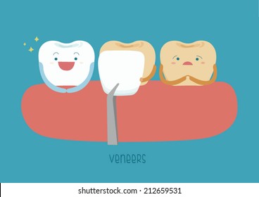 Veneers teeth of dental 