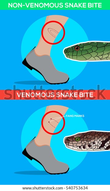 Venomous Non Venomous Snake Bite Leg Stock Vector (Royalty Free) 540753634