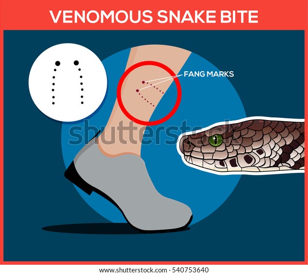 Venomous Snake Bite Leg Beware Snakes Stock Vector (Royalty Free) 540753640