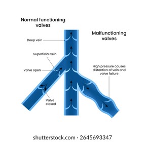 Venous Valve Function and Dysfunction