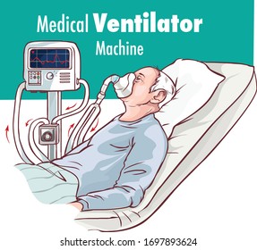 Ventilator Medical Machine Equipment fo Tracheostomy Patient Breathing in Operating Room Surgery Hospital Clinical ICU Intensive 