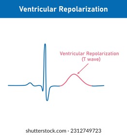 Ventricular repolarization, T wave. The QT interval of ECG. The cardiac cycle. ECG of a heart in normal sinus rhythm. Resources for teachers and students.