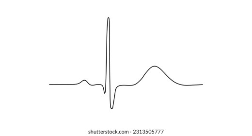 Repolarización ventricular, ola T. Intervalo QT del ECG. El ciclo cardíaco. ECG de un corazón con ritmo sinusal normal. Recursos para profesores y estudiantes.