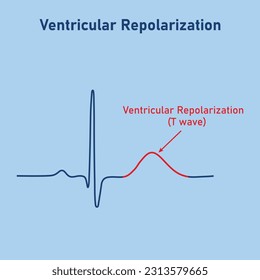 Ventricular repolarization, T wave. The QT interval of ECG. The cardiac cycle. ECG of a heart in normal sinus rhythm. Resources for teachers and students.