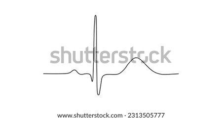 Ventricular repolarization, T wave. The QT interval of ECG. The cardiac cycle. ECG of a heart in normal sinus rhythm. Resources for teachers and students.