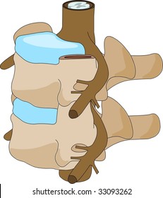 Vertebra Spinal Disc